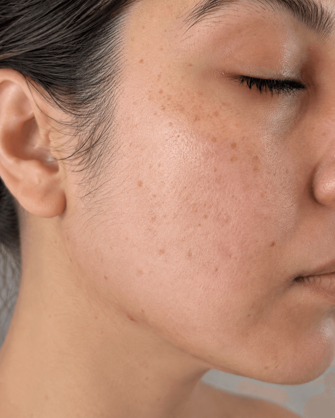 Before — Uneven tone · Spots