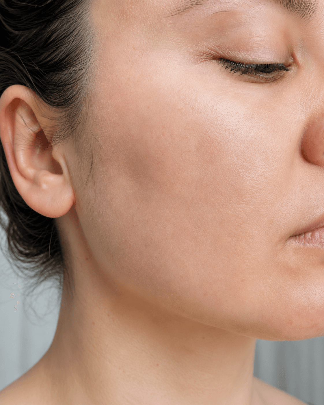 After — Sensitivity · Redness