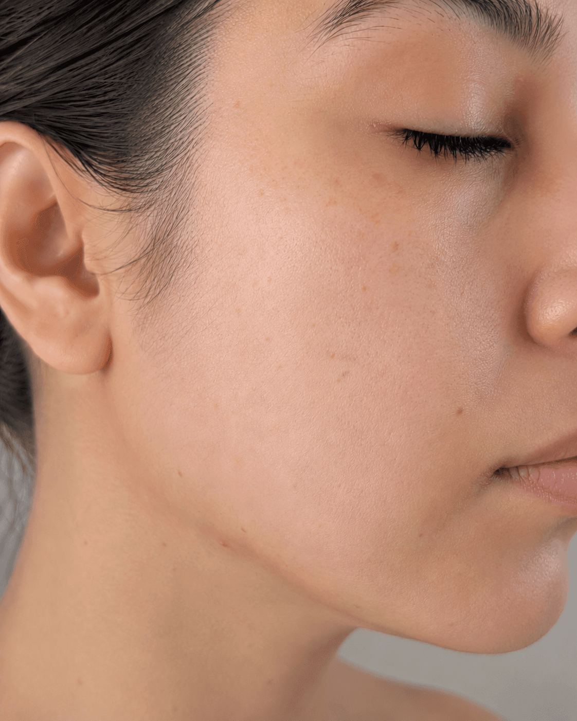 After — Uneven tone · Spots