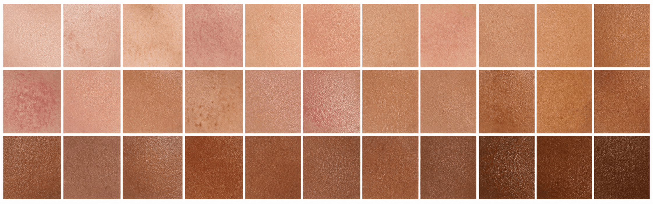 Grid of skin-image samples representing the DermAI training set across multiple ethnicities, ages, and conditions